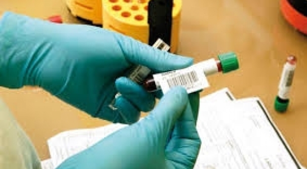 Un cas de fièvre hémorragique confirmé en Mauritanie