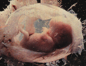 Un foetus d’environ 7 mois retrouvé dans un WC à Tougue